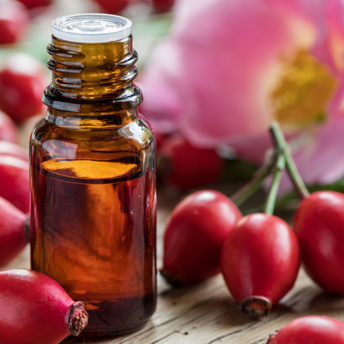 amber bottle of rosehip oil surrounded by rosehips and a pink rosehip flower