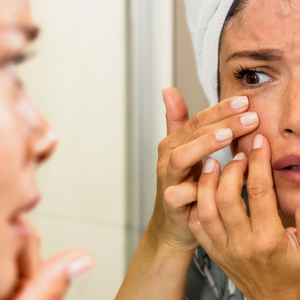 Scary Stuff on Your Skin and How to Keep it in Balance